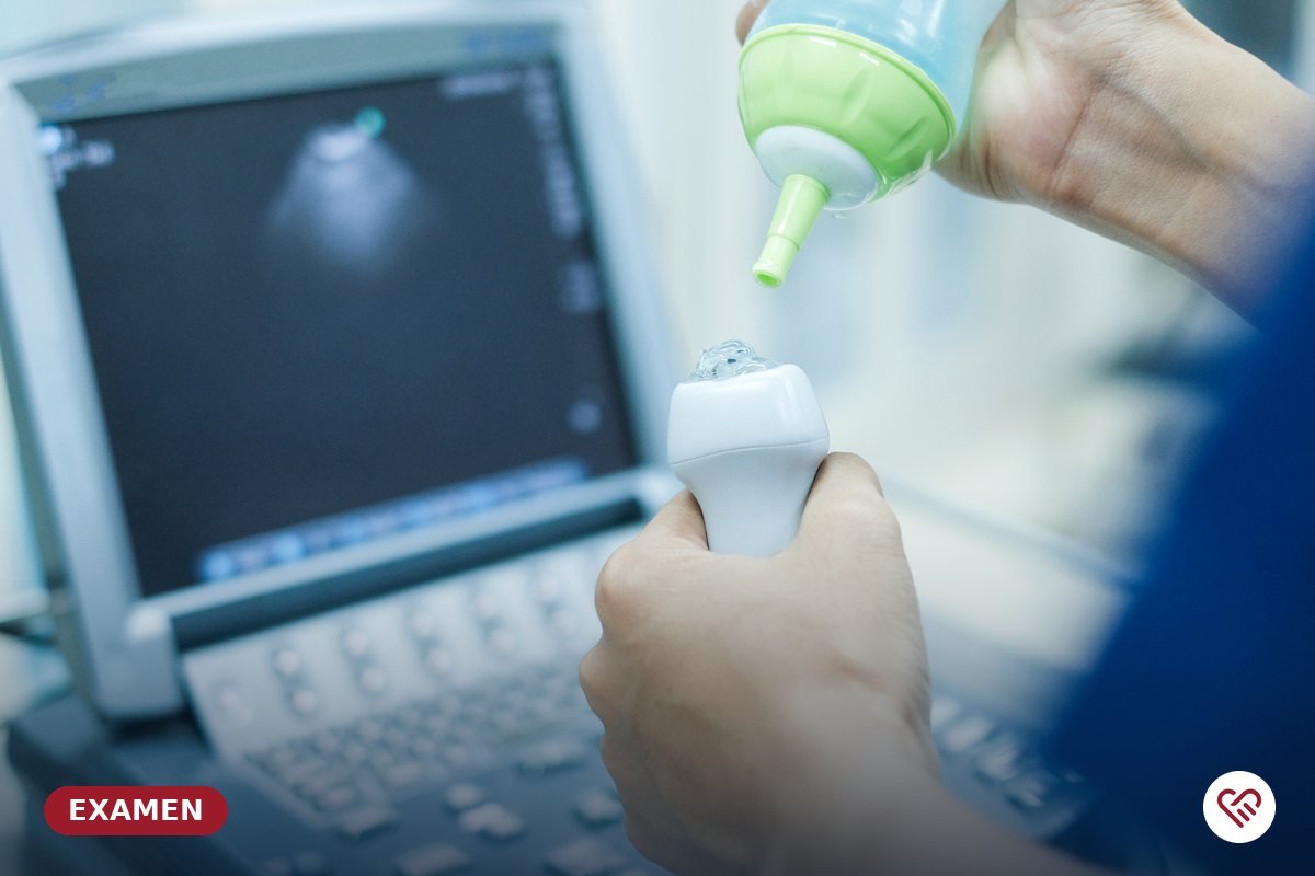 L'échographie cardiaque et vasculaire — cabinet du Dr Agueznai
