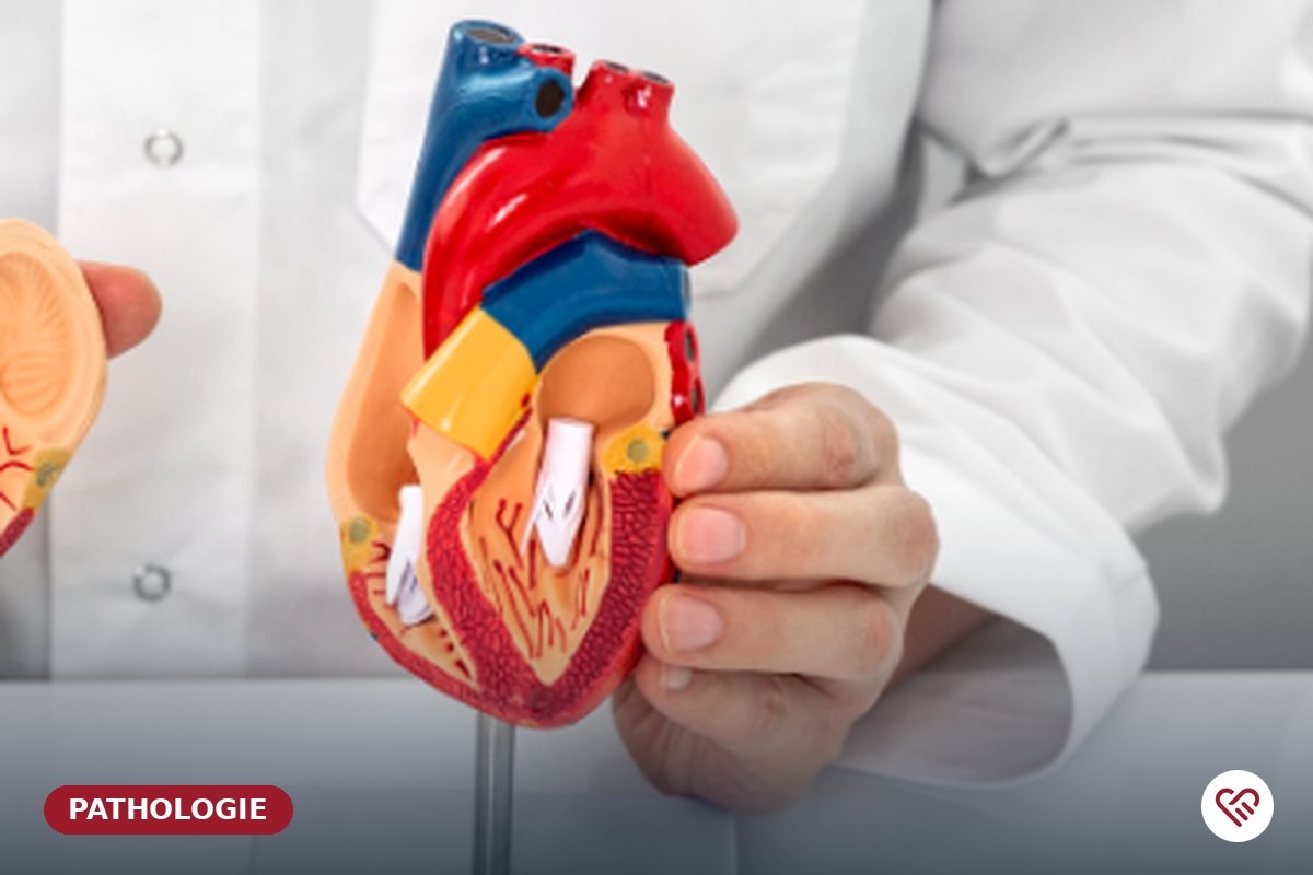 La péricardite — Dr Agueznai, cardiologue à Casablanca