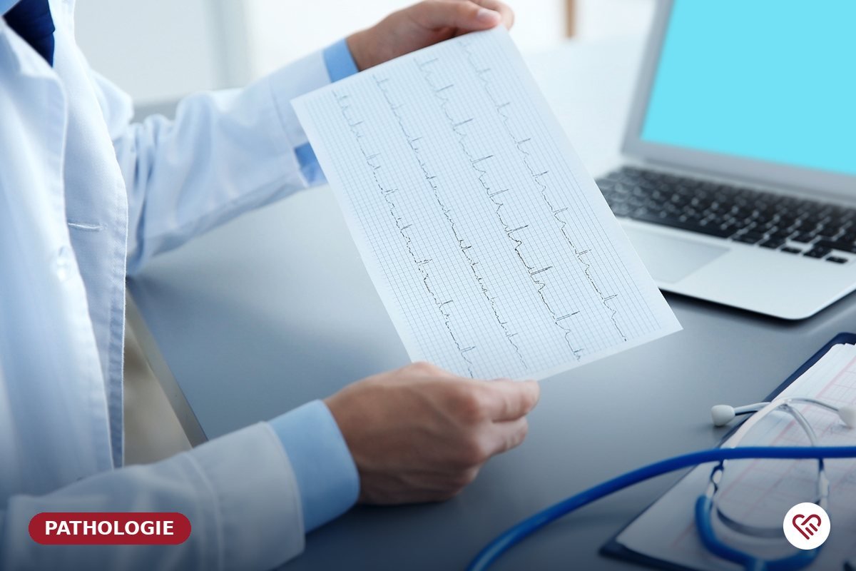 Les troubles du rythme cardiaque — Dr Agueznai, cardiologue à Casablanca